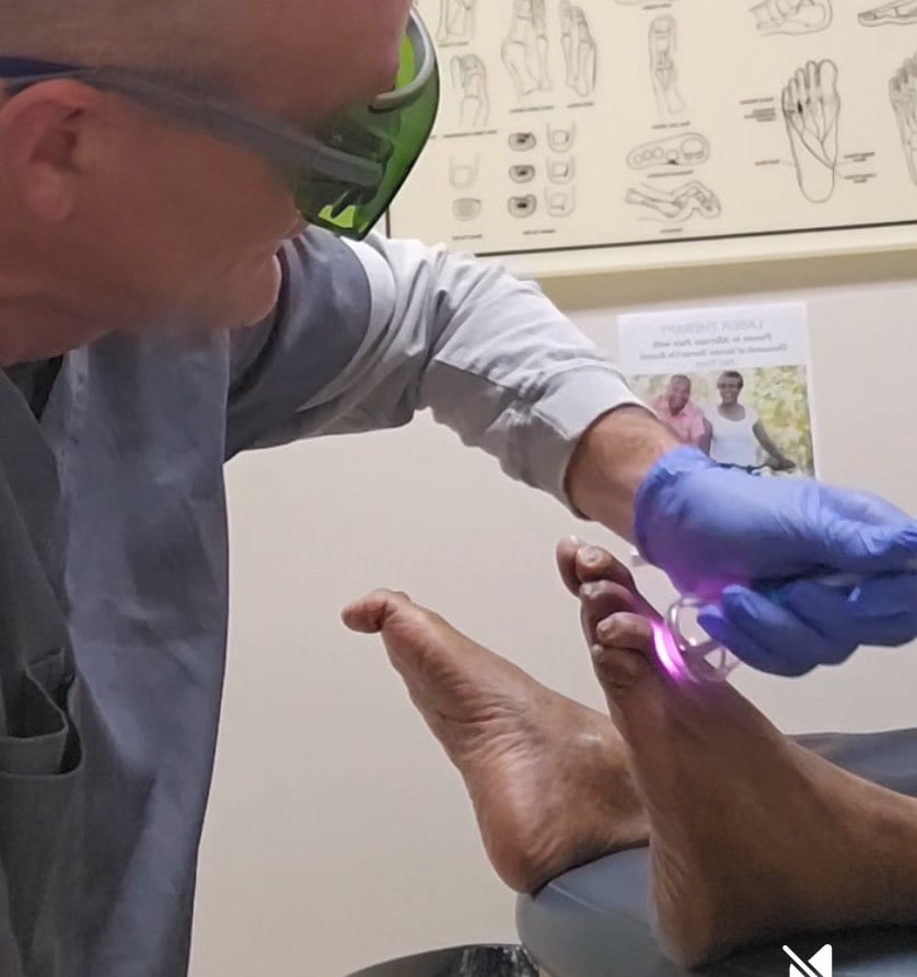 class iv laser foot pain