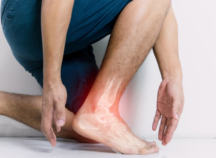 Foot & ankle arthritis
