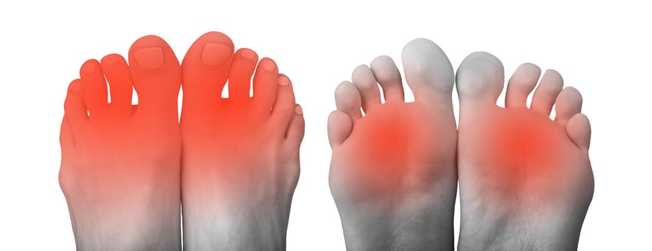 neuropathy feet